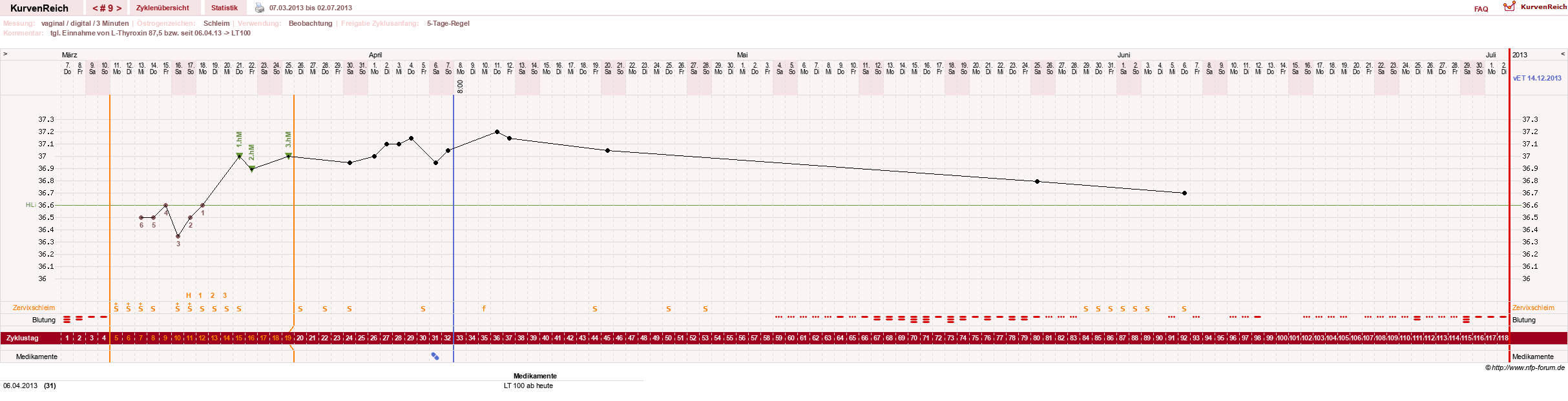 NFP-Kurve User #17672