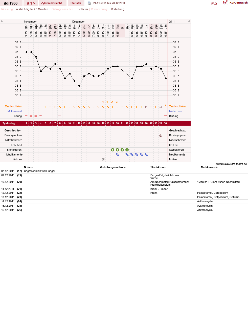 NFP-Kurve User #17675