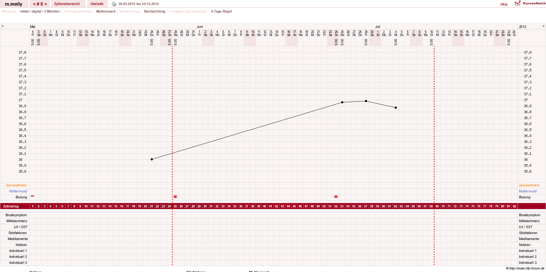 NFP-Kurve User #17756