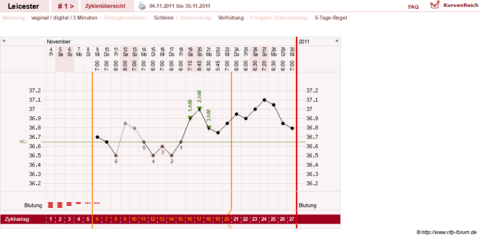 NFP-Kurve User #17811