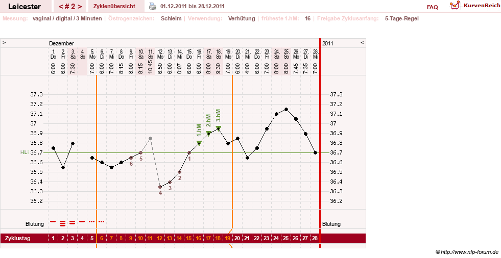 NFP-Kurve User #17811