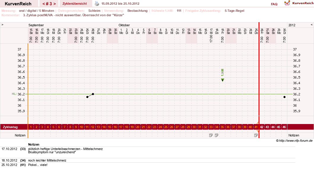 NFP-Kurve User #17941