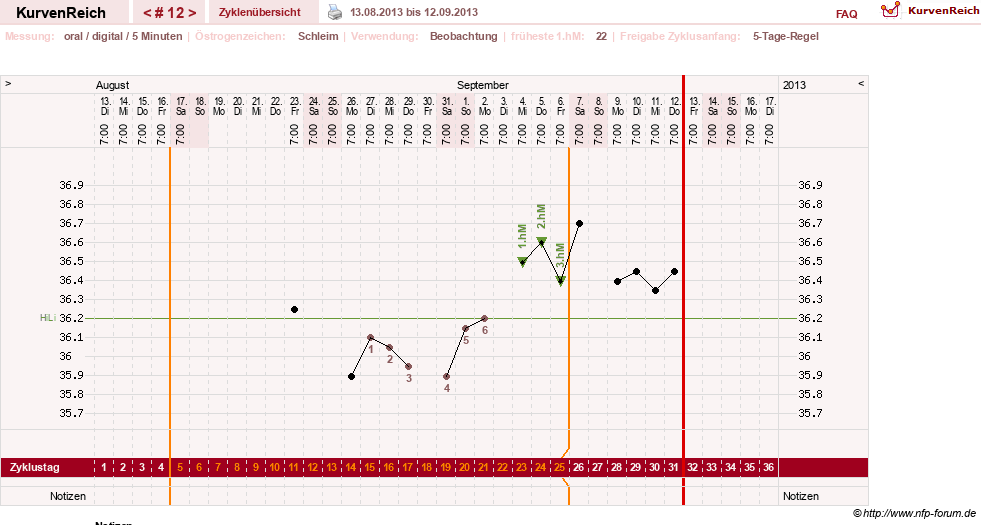 NFP-Kurve User #17941