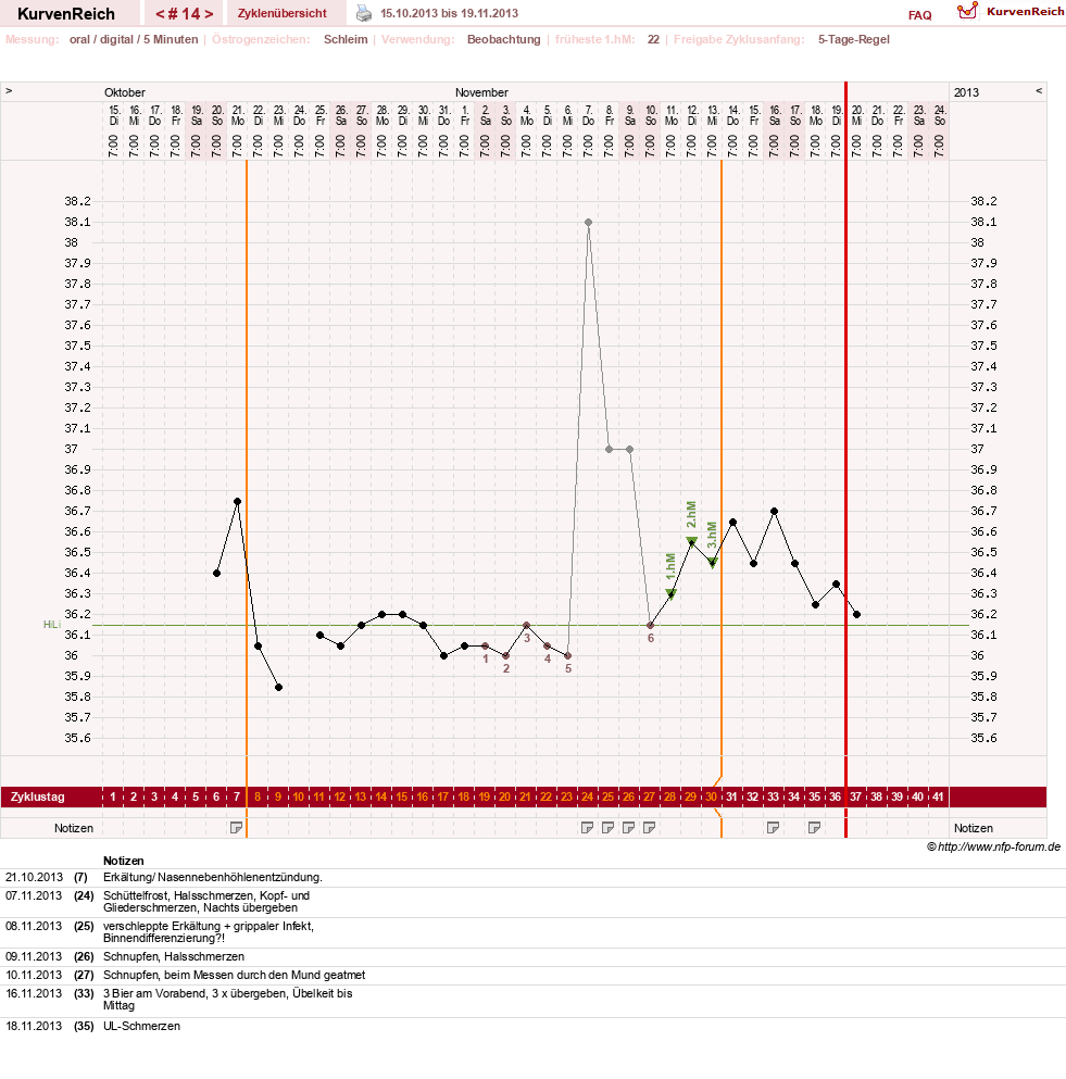 NFP-Kurve User #17941