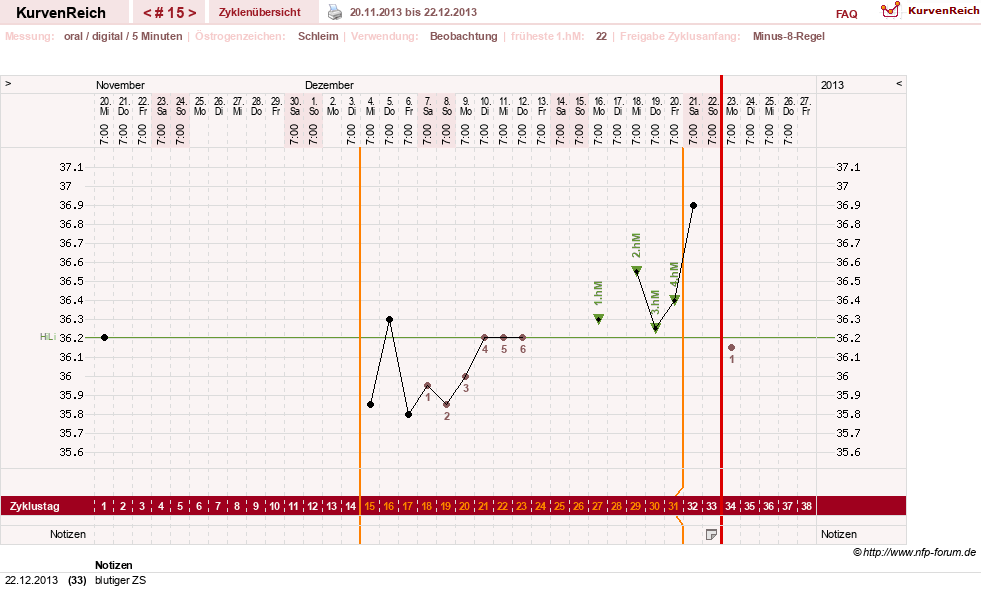 NFP-Kurve User #17941