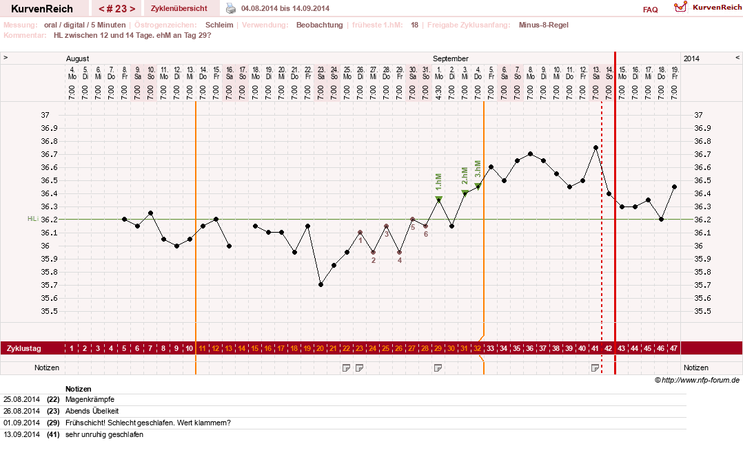 NFP-Kurve User #17941