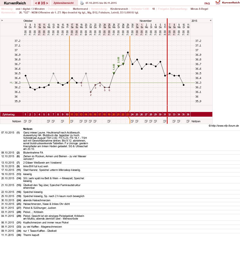 NFP-Kurve User #17941