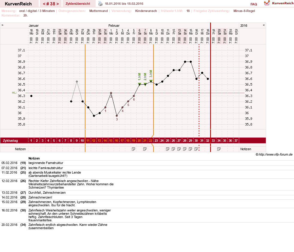 NFP-Kurve User #17941