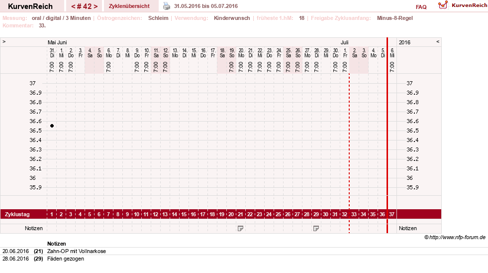NFP-Kurve User #17941