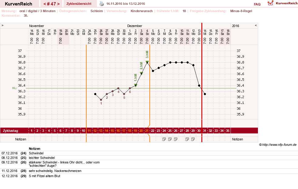 NFP-Kurve User #17941