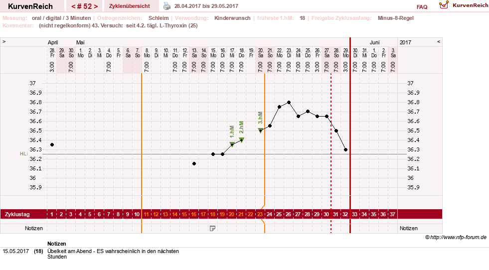 NFP-Kurve User #17941