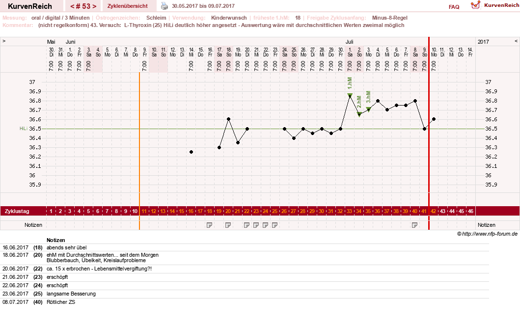 NFP-Kurve User #17941