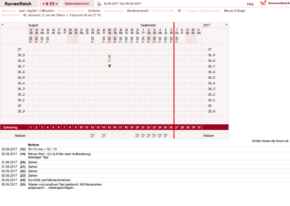 NFP-Kurve User #17941