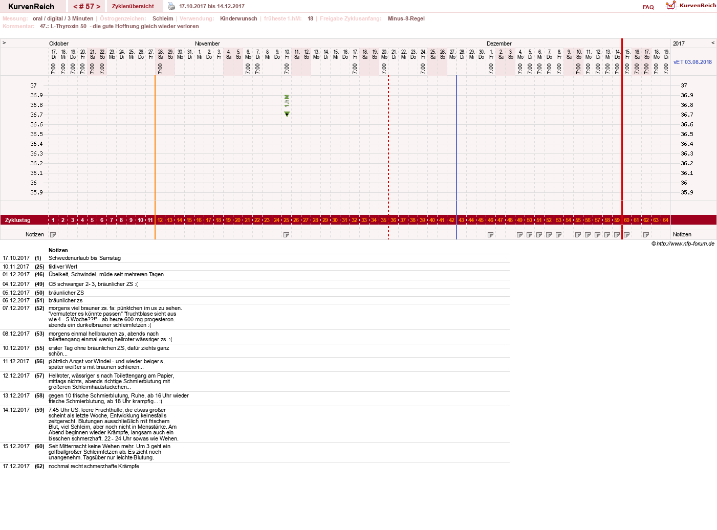 NFP-Kurve User #17941