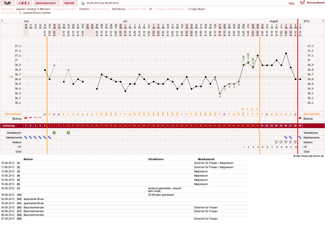 NFP-Kurve User #17988