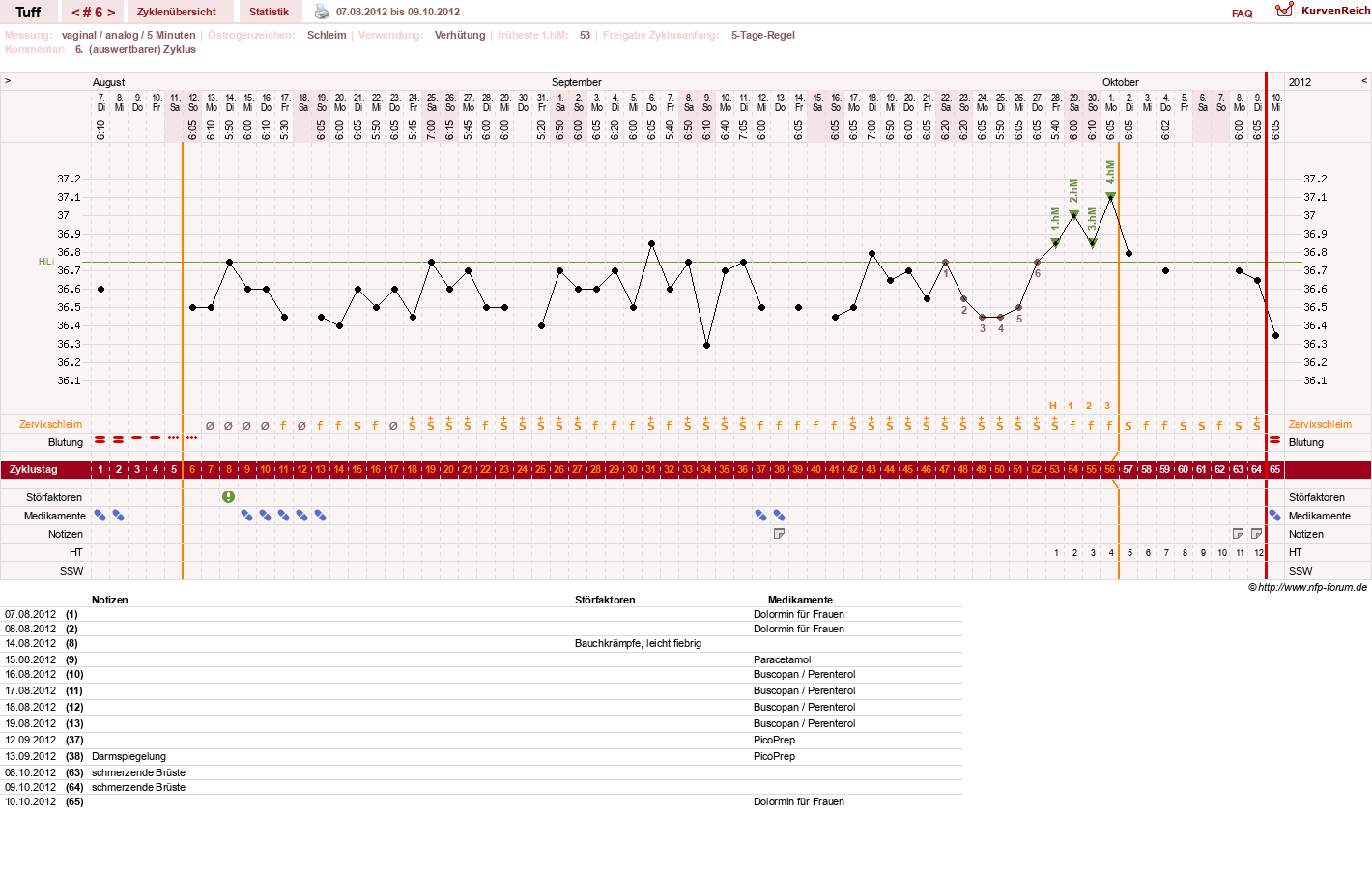 NFP-Kurve User #17988