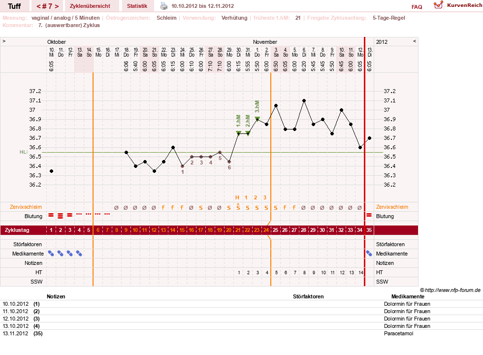 NFP-Kurve User #17988