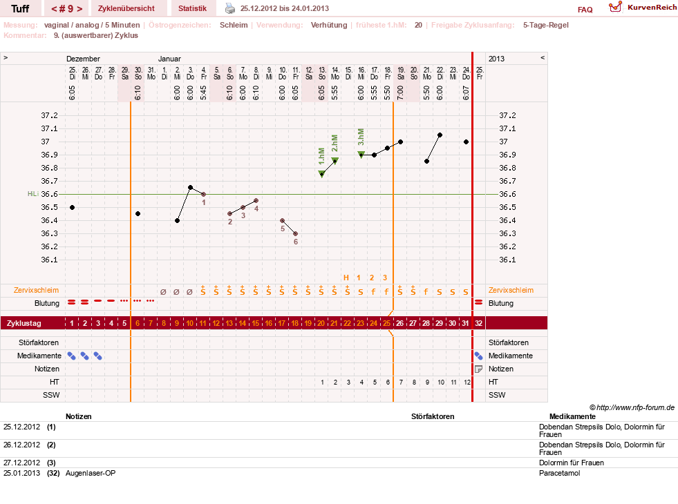 NFP-Kurve User #17988