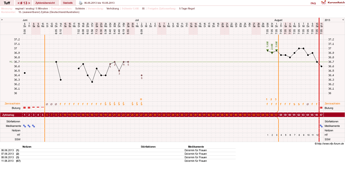 NFP-Kurve User #17988