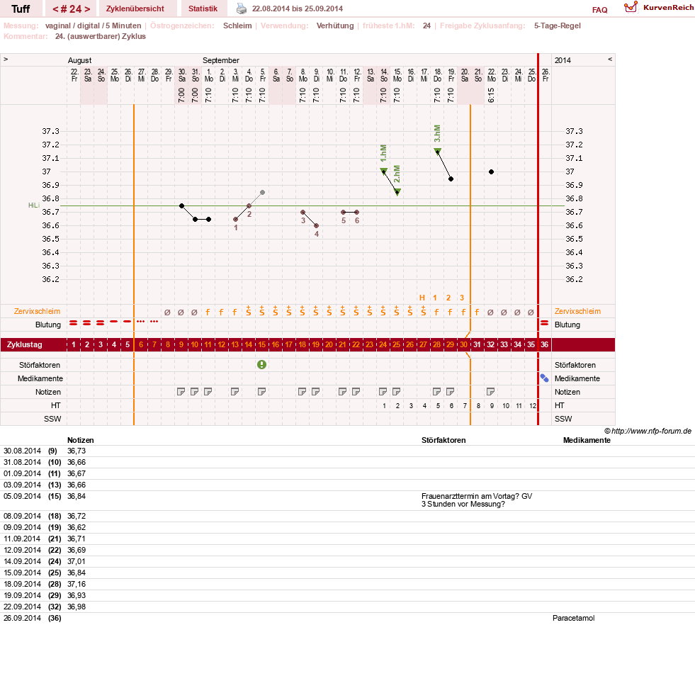 NFP-Kurve User #17988
