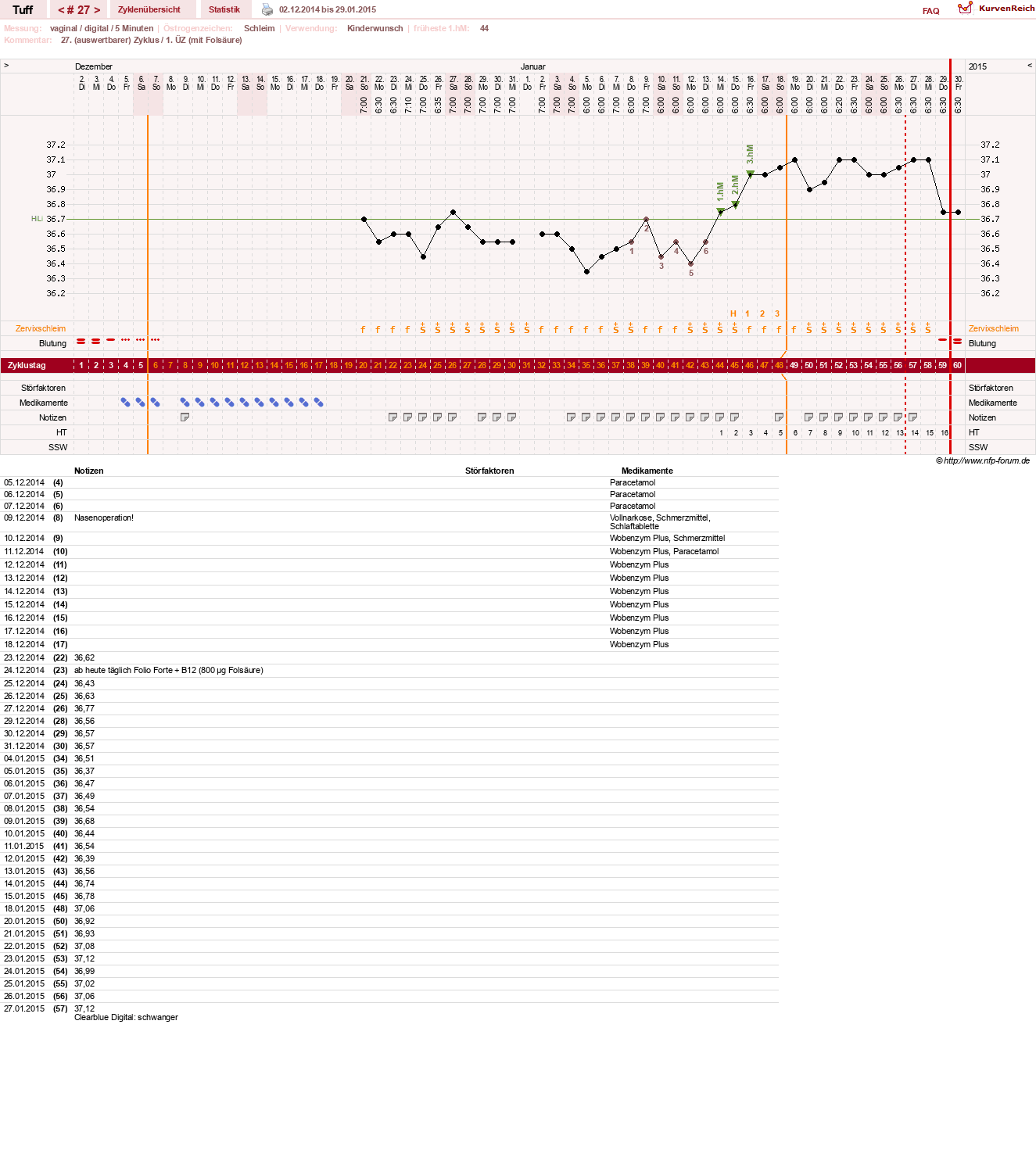 NFP-Kurve User #17988