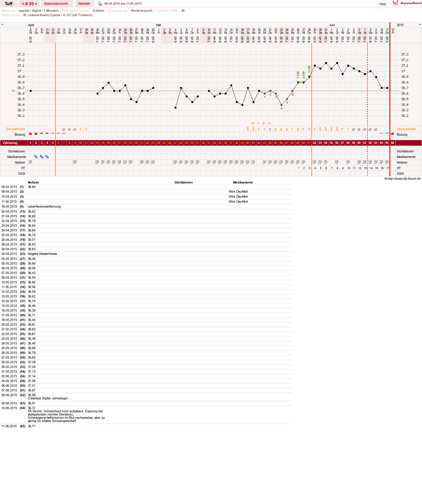 NFP-Kurve User #17988