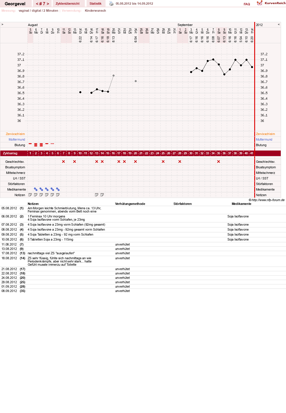 NFP-Kurve User #17992
