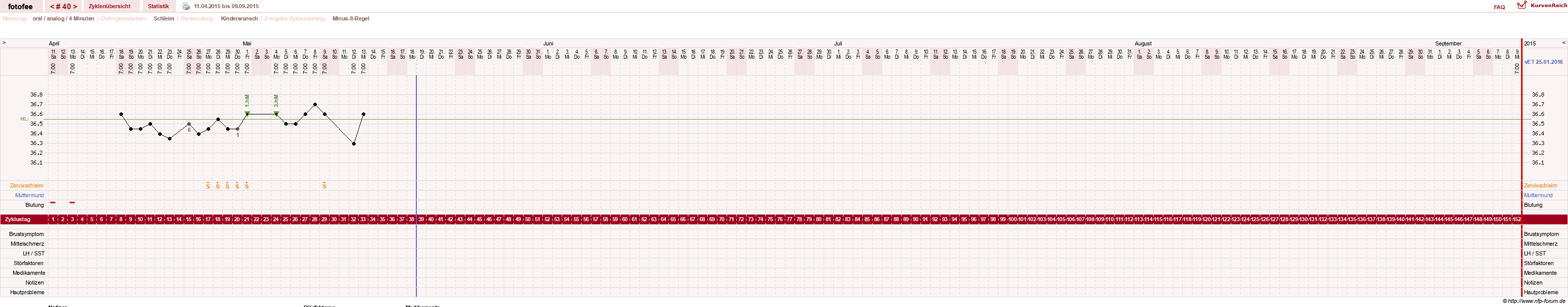 NFP-Kurve User #18112