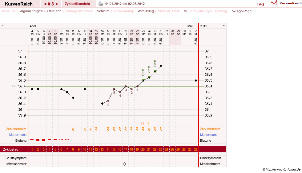 NFP-Kurve User #18134