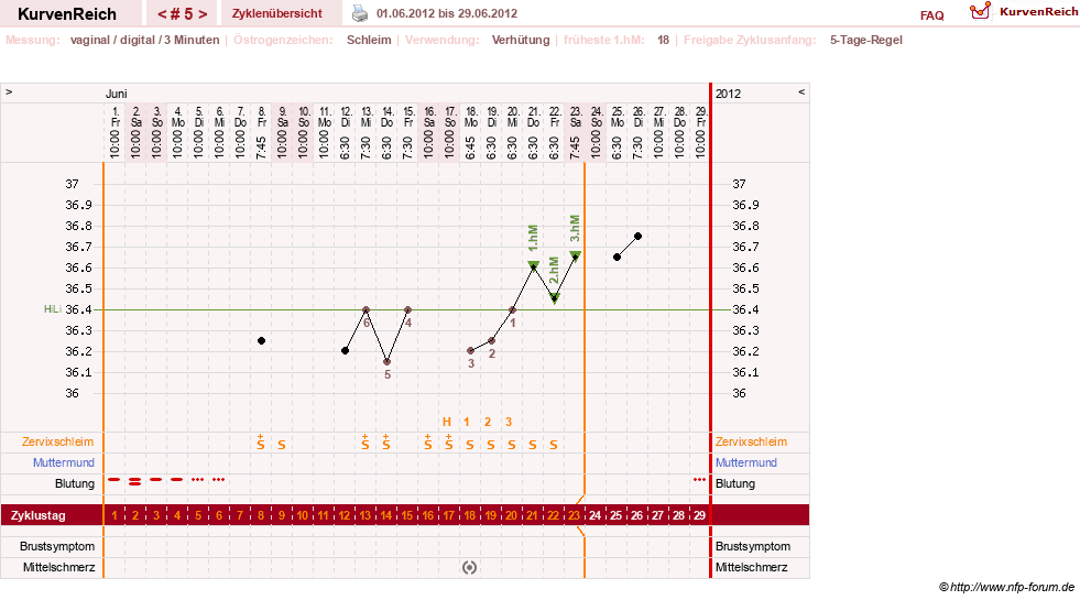 NFP-Kurve User #18134