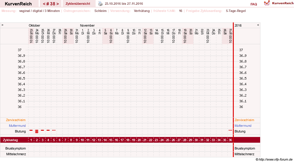 NFP-Kurve User #18134