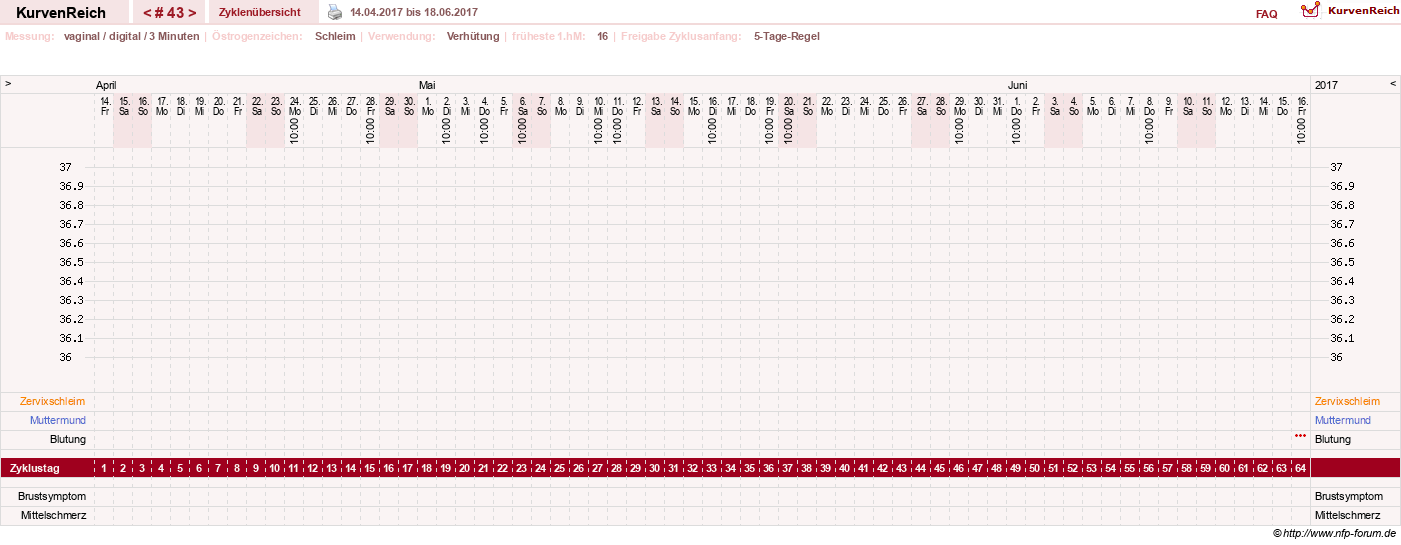 NFP-Kurve User #18134