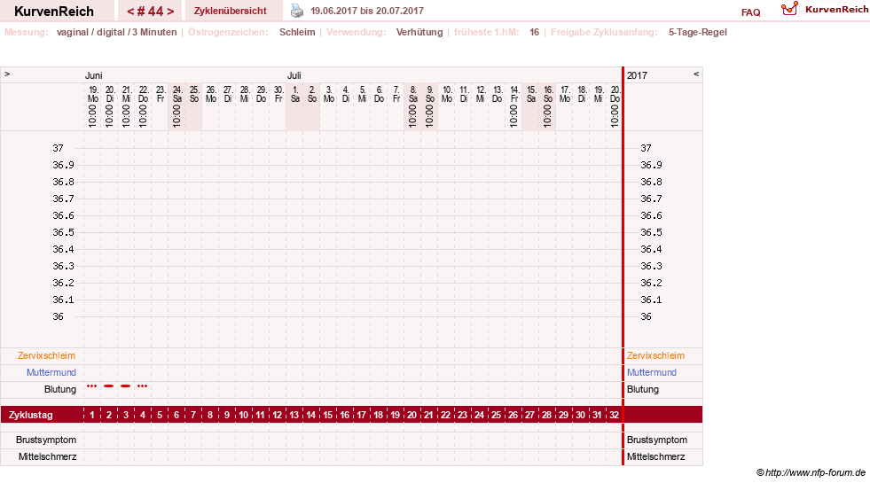 NFP-Kurve User #18134