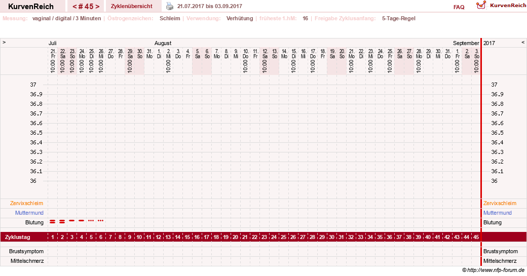 NFP-Kurve User #18134