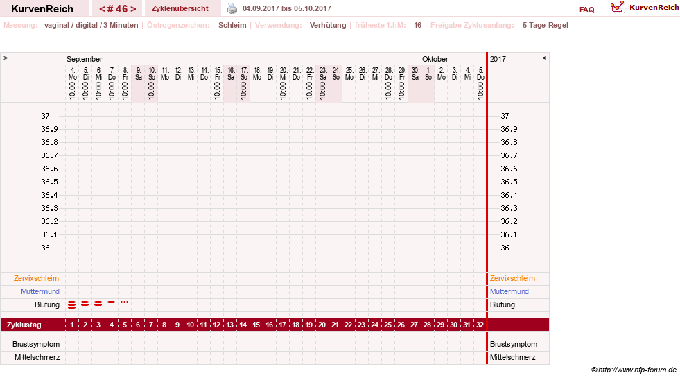 NFP-Kurve User #18134