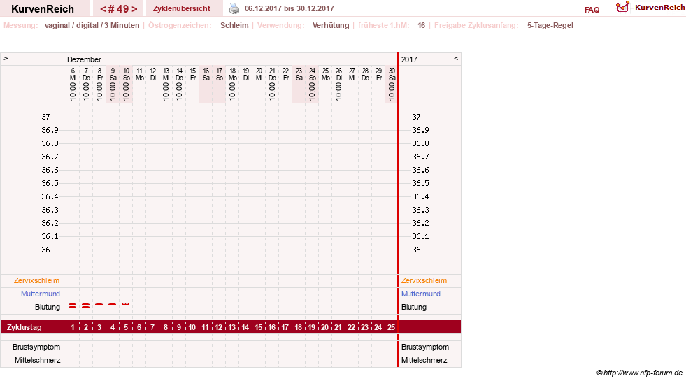 NFP-Kurve User #18134