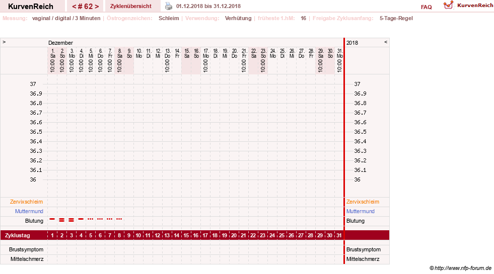 NFP-Kurve User #18134