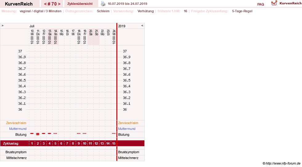 NFP-Kurve User #18134