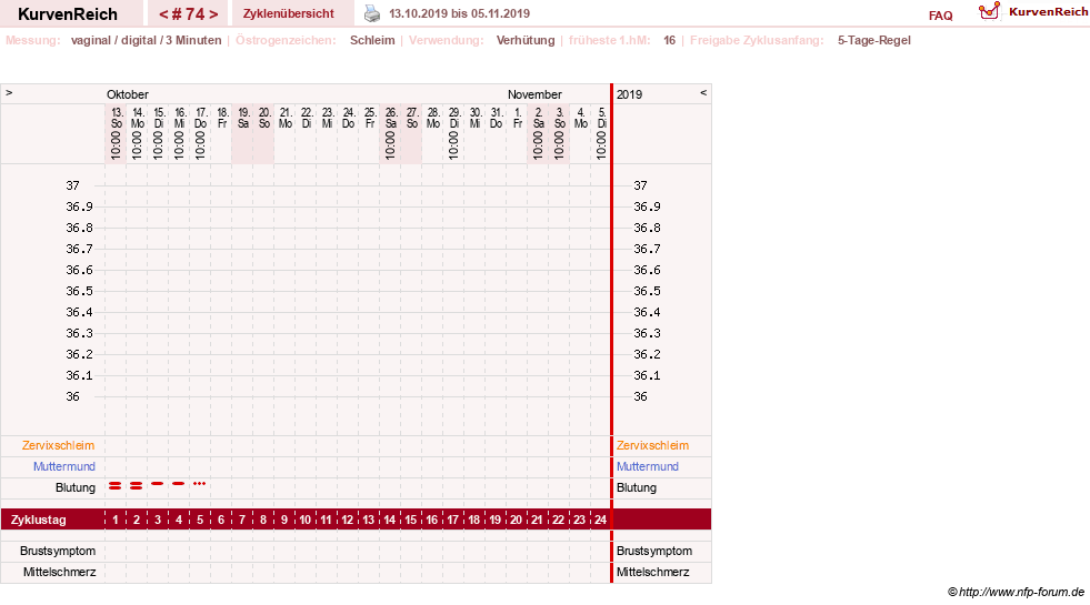 NFP-Kurve User #18134