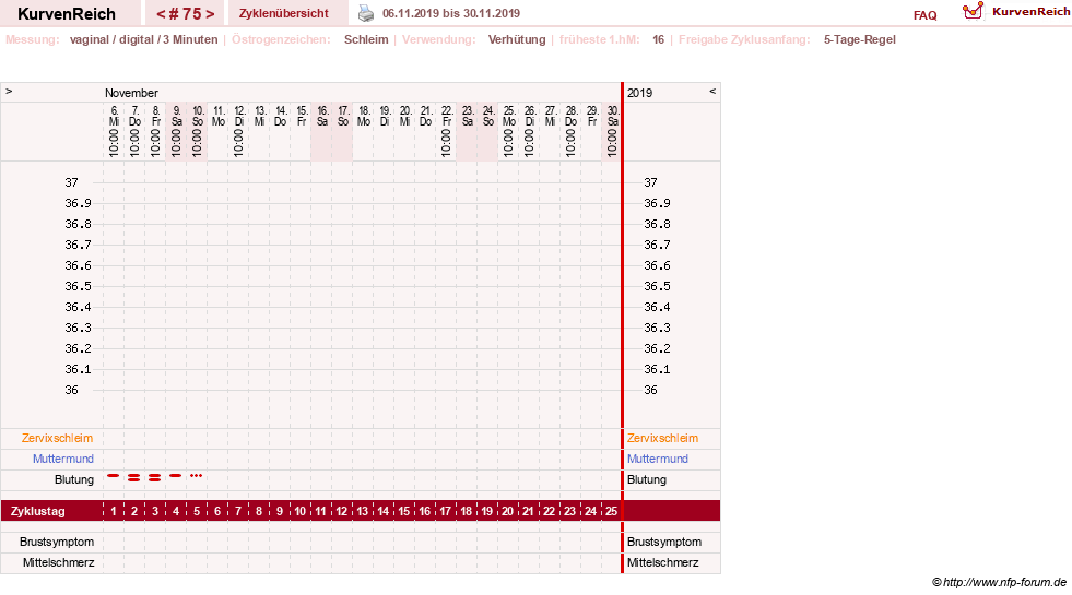 NFP-Kurve User #18134
