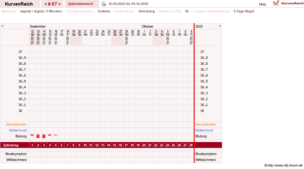 NFP-Kurve User #18134
