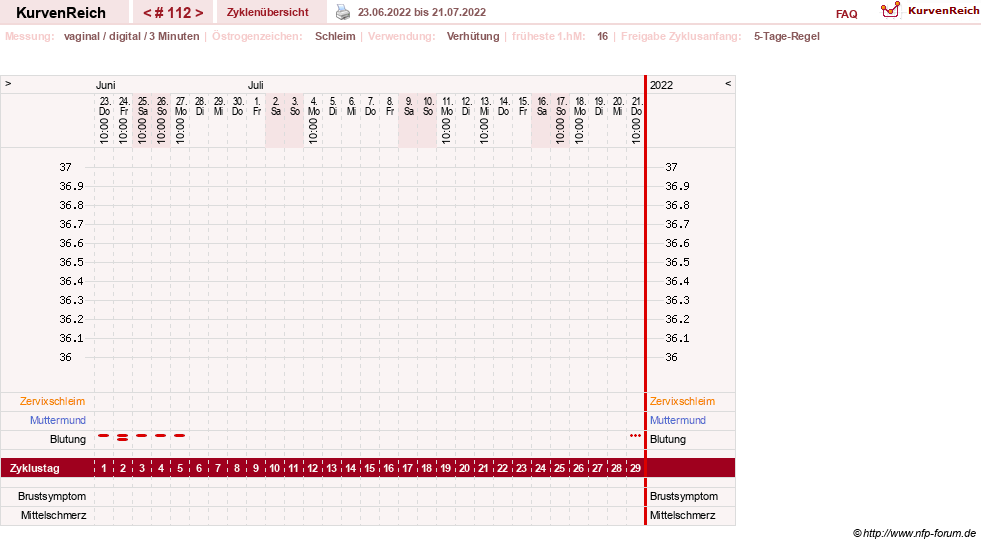 NFP-Kurve User #18134