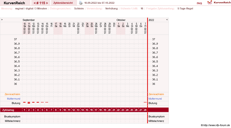 NFP-Kurve User #18134