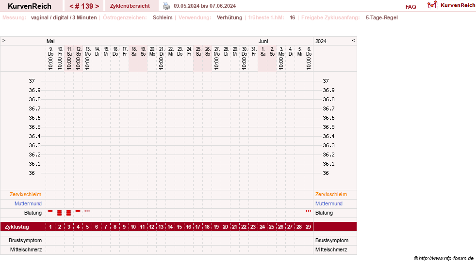 NFP-Kurve User #18134