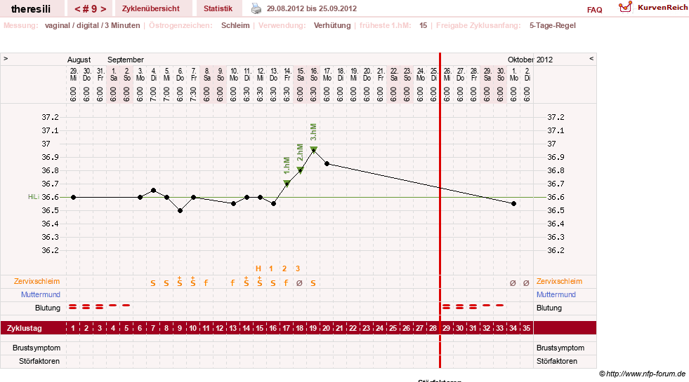 NFP-Kurve User #18189