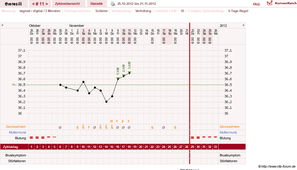 NFP-Kurve User #18189