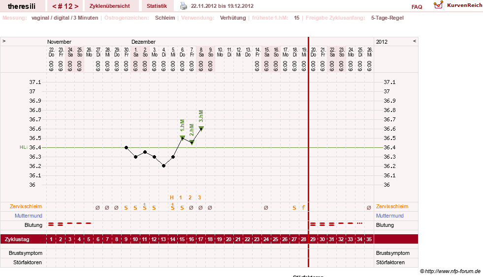NFP-Kurve User #18189