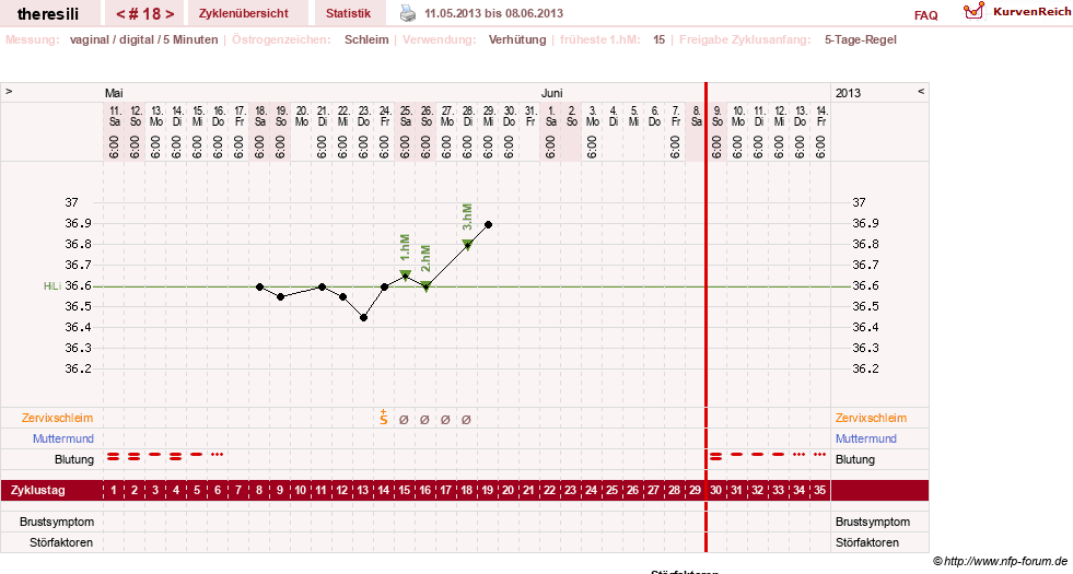 NFP-Kurve User #18189