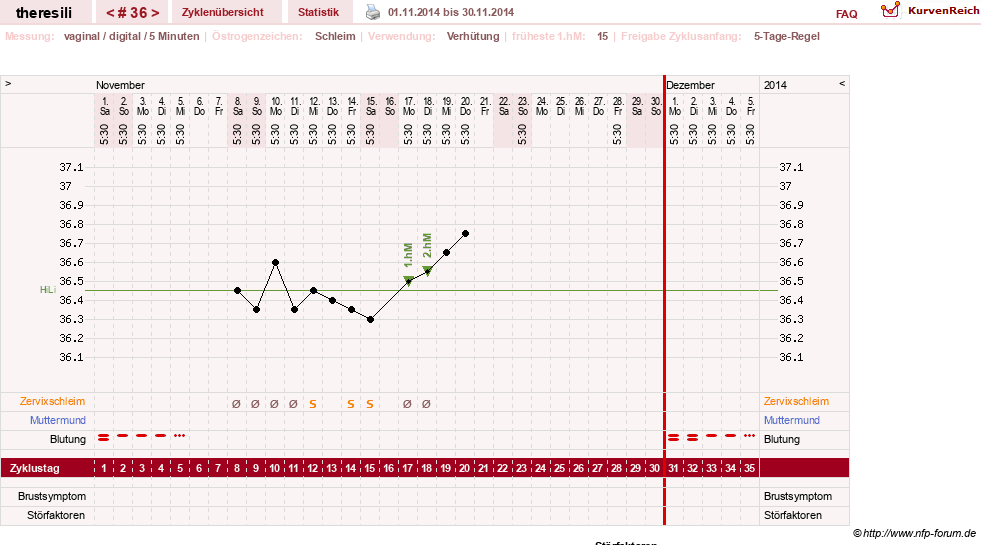 NFP-Kurve User #18189