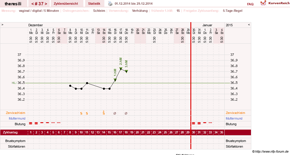 NFP-Kurve User #18189
